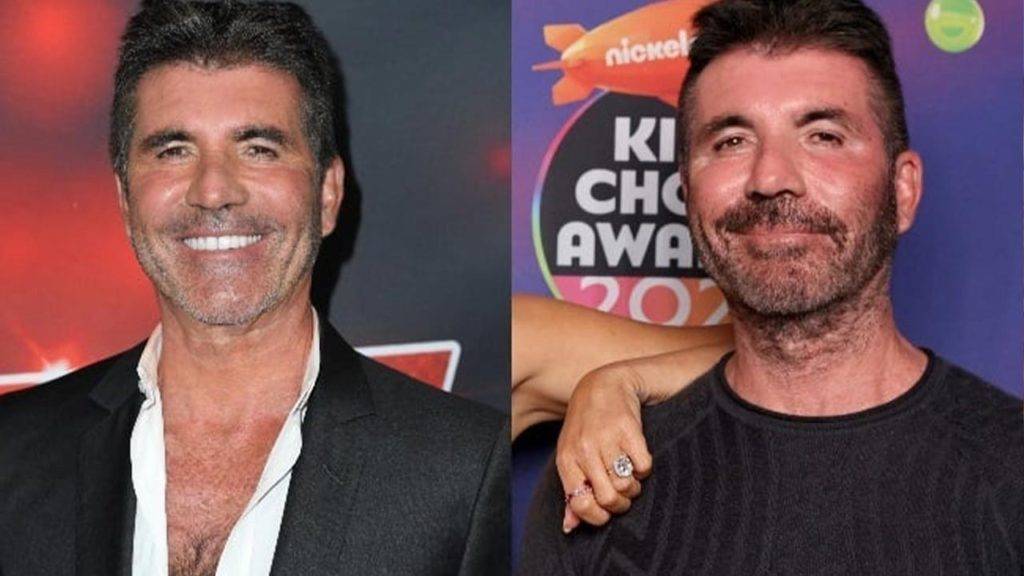 Is Simon Cowell Dead, Surgery And Hospital? NAYAG News