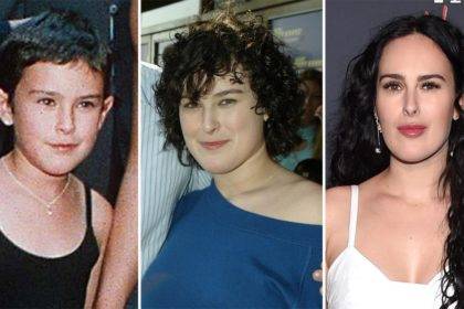 Rumer Willis Plastic Surgery