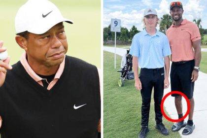 What Happened to Tiger Woods Leg in Accident?